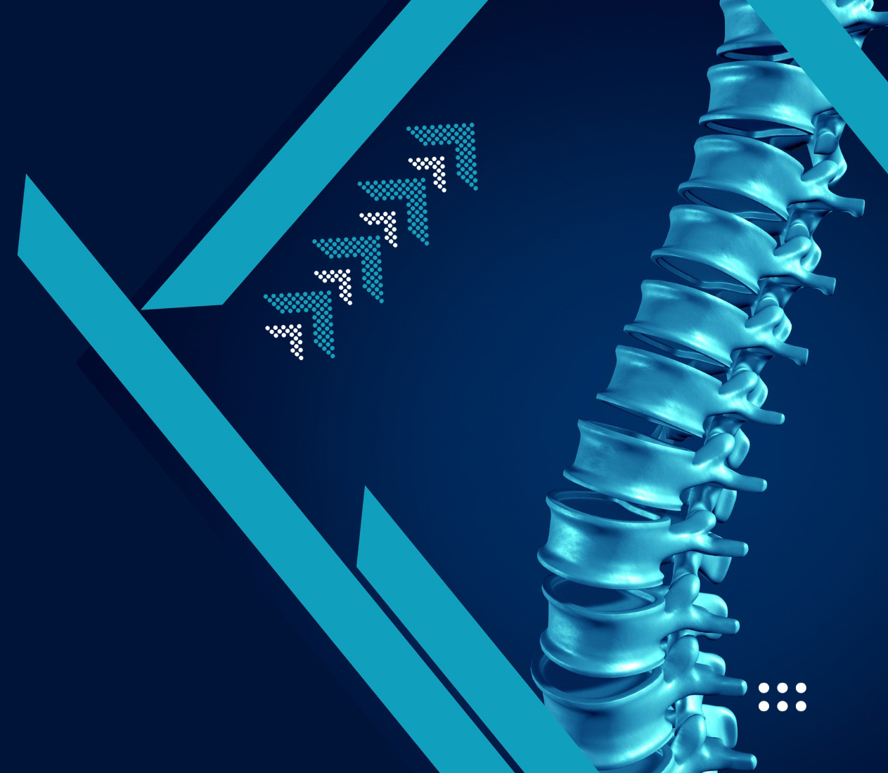 slide-4-spine